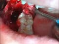 TOOTH!!