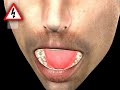 TOOTH!!