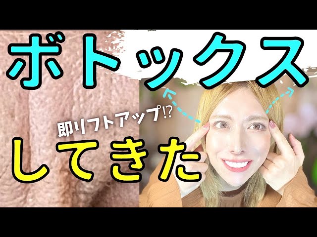 チャンネルを管理