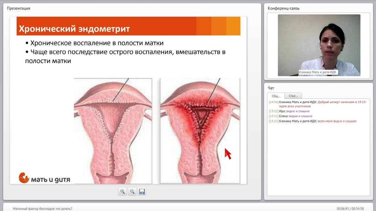 Как эндометрий сделать меньше Как эндометрий сделать меньше