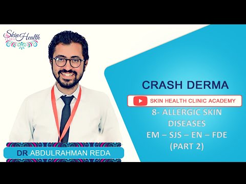 8- ALLERGIC Drug Eruption (PART 2) شرح الجلدية الطفح الدوائي د.عبدالرحمن رضا 8- ALLERGIC Drug Eruption (PART 2) شرح الجلدية الطفح الدوائي د.عبدالرحمن رضا #1