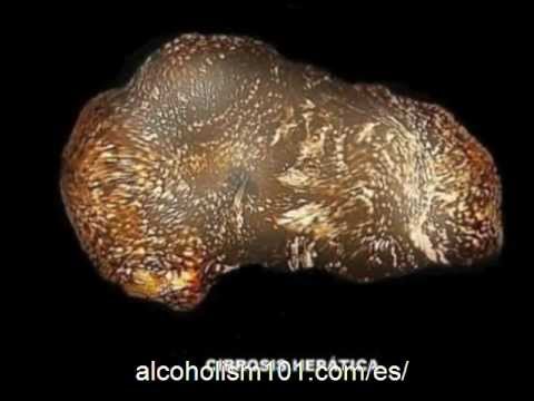La codificación del alcohol moskva es barato