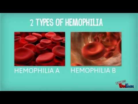 what is hemophilia Hemophilia definition, any of several x-linked genetic disorders, symptomatic chiefly in males, in which excessive bleeding occurs owing to the absence or abnormality of a clotting factor in the blood. what is hemophilia Hemophilia definition, any of several x-linked genetic disorders, symptomatic chiefly in males, in which excessive bleeding occurs owing to the absence or abnormality of a clotting factor in the blood.