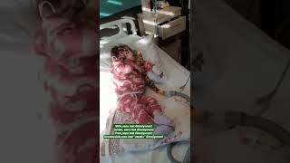 Boğazımdan Geçecek Bir Lokma Yemek, Bir Yudum Su Benim Hayalim Onerayse57
