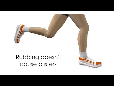 What Causes Foot Blisters - A Discussion of Friction, Shear & Rubbing