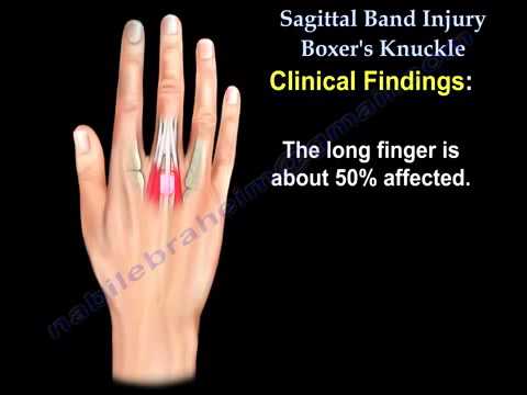 Communication on this topic: How to Know if You Sprained Your , how-to-know-if-you-sprained-your/ Forum on this topic: How to Know if You Sprained Your , how-to-know-if-you-sprained-your/