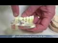 TOOTH!!