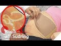 Wurm im Babybauch! Ist das Baby in Gefahr? | Klinik am Südring | SAT.1