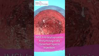 Unveiling The Secrets Imsi Explained Vizag Icf Centre