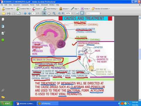 Meningitis - Signs and