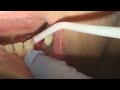 TOOTH!!
