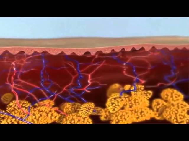 Radio Frequency & Non Surgical Facial Videos