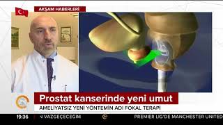 24Tv Akşam Haberlerinde Fokal Tedavi