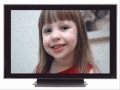 Visual Snow: Television like static in your vision?