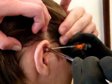 Tags: piercing tragus helix barni Tags: piercing tragus helix barni