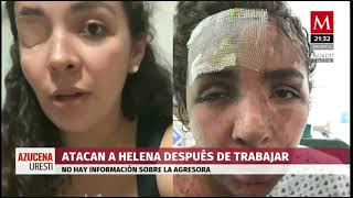 Los Ataques Con Ácido En Contra De Mujeres, Una Triste Realidad En México