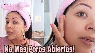Cómo eliminar los Poros Abiertos Para siempre! 💯 Efectivo/ trucos de Belleza