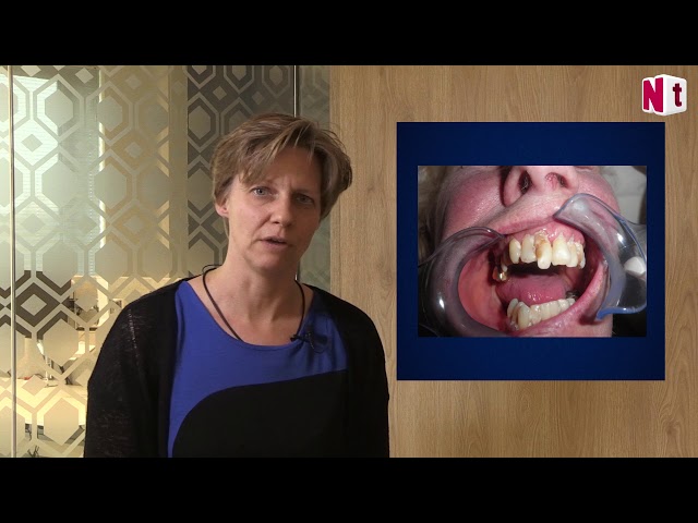 Watch Omgaan met mensen met dementie on YouTube.