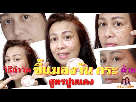 วิธีกำจัดขี้แมลงวัน กระ ด้วยสูตรปูนแดง/ครัวแม่น้อง
