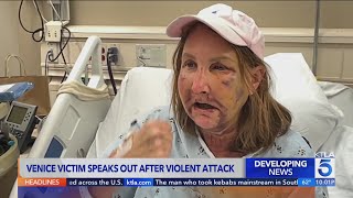 Woman recalls being nearly beaten to death by Venice canal attacker