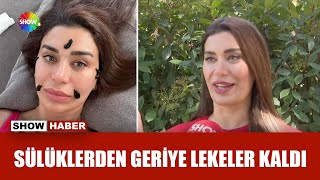 Sülükler Ebru Şancıyı Perişan Etti