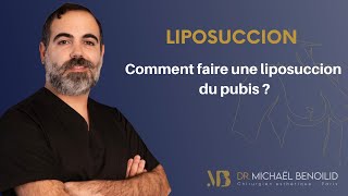 La Liposuccion Du Pubis