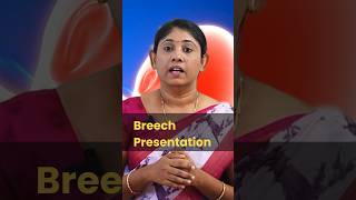 Breech Presentation