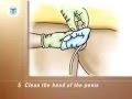 المركز الأساسي : ذكر اغسل القضيب العجانية