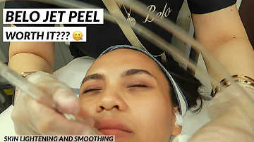 C'est quoi le jet Peel ?