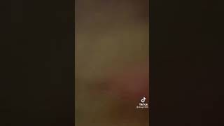Biến Hình Nè Anh Em P1