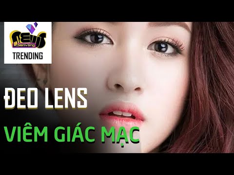 Đeo kính áp tròng làm đẹp mùa Tết, cô gái trẻ bị viêm giác mạc