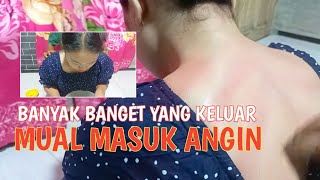 Masuk Angin Mual Siang Hari
