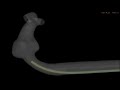 micro catheter