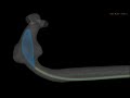 micro catheter