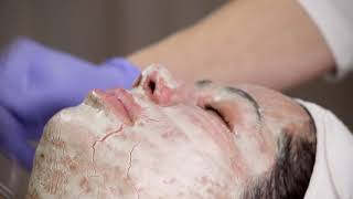 DMK Skin Games - Week 8 Eczema Case Study