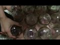 Traditional Chinese Medicine TCM Cupping Schröpfen in China 拔罐子 カッピング療法 Ventosaterapia
