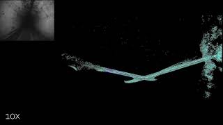 Learning-based Localizability Estimation for Robust LiDAR Localization (supplementary)