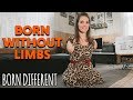 Born Without Limbs And I Can Still Do Anything | BORN DIFFERENT
