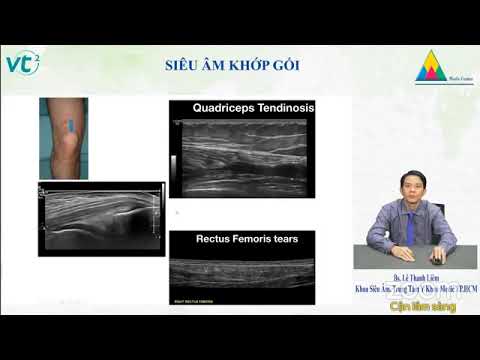 SIÊU ÂM KHỚP GỐI | Bs. Lê Thanh Liêm