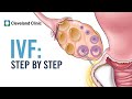 How Does In Vitro Fertilization (IVF) Work? A Step-by-Step Explanation