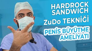 Penis Büyütme Ameliyatı | Hardrock Sandviç | Zudo Tekniği