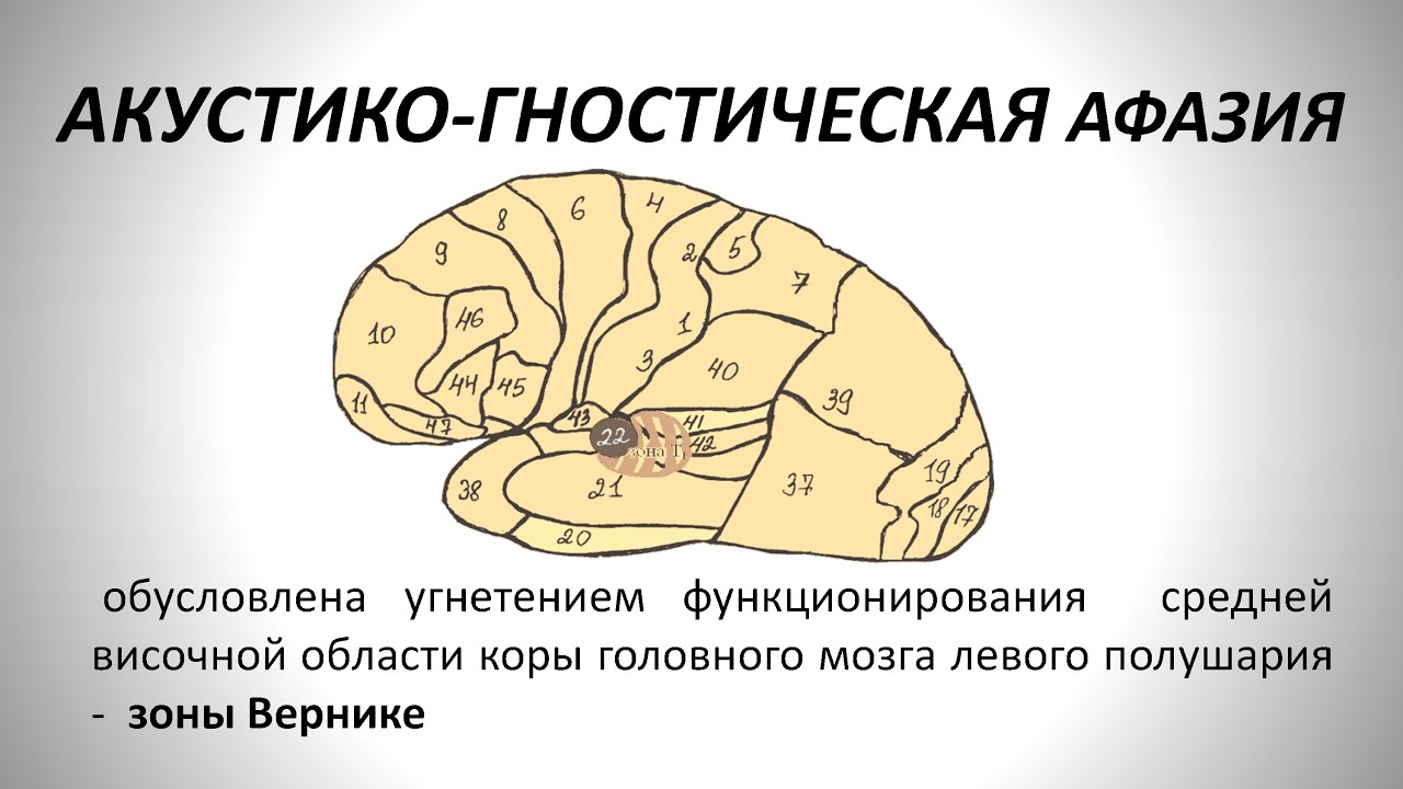 Схемы и таблицы по афазии Схемы и таблицы по афазии
