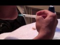 I Drain My Own Elbow In Paris France And You Sick Monkeys Are Entertained! *GRAPHIC* - Mike Swick