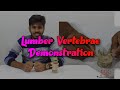 Lumber Vertebrae in bangla || Typical & Atypical Lumber vertebrae demonstration