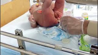 Icu Distention For Constipation Relief