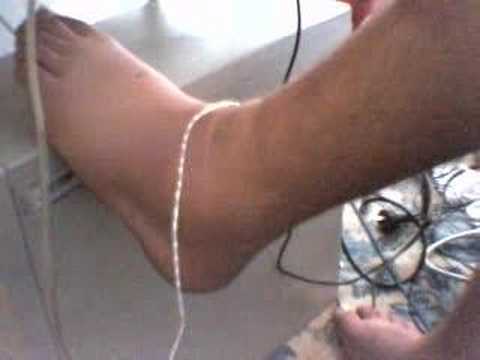Whitetail spider bite? Whitetail spider bite? 0:27. Who likes puss! Whitetail spider bite? Whitetail spider bite? 0:27. Who likes puss!