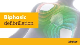 3D Biphasic Defibrillation Clinical Animation