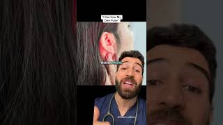 Doctor Explains When You Hear Your Heartbeat