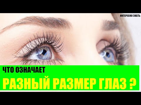 Что означают глаза разного размера? Что означают глаза разного размера?