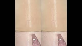 View Photos On Slinktr.eeyleg